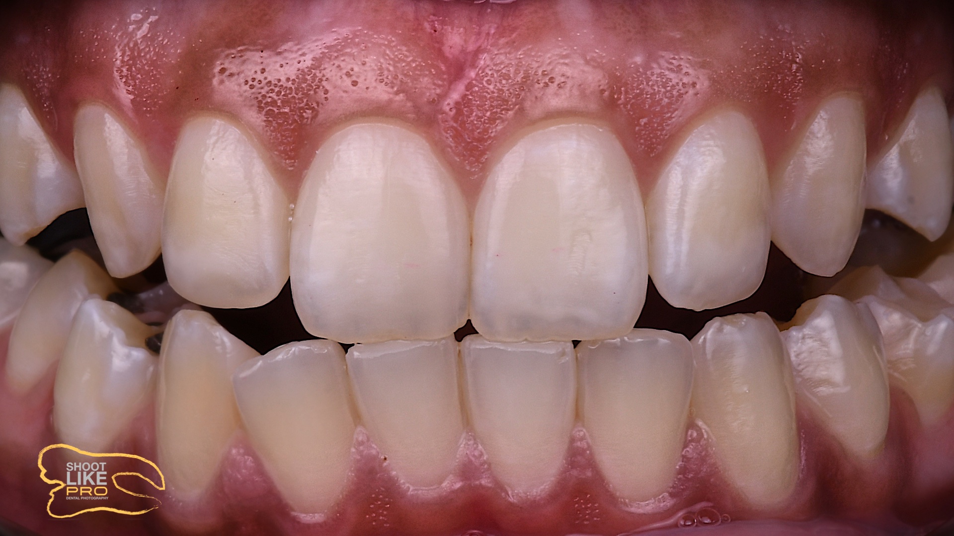 Intraoral photos DentalProMaster