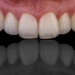 intraoral dental photography