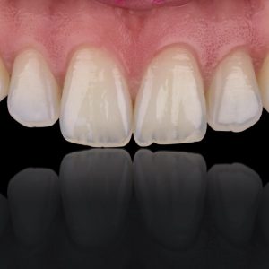 intraoral dental photography