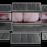 close-up dental photography