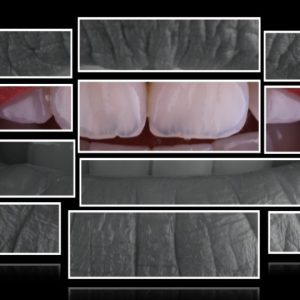 close-up dental photography