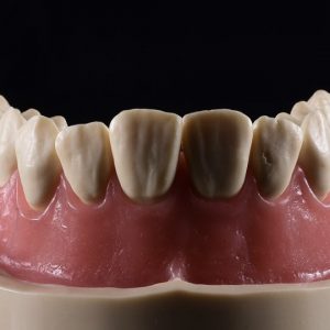 laboratory dental photography