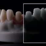 laboratory dental photography
