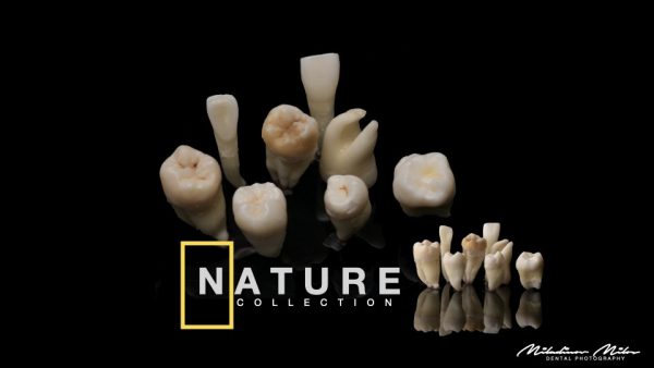 natural teeth dental photography