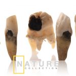 natural teeth dental photography